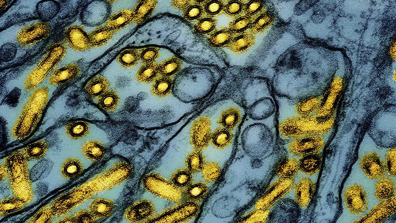 A colorised electron microscope image of avian influenza H5N1.